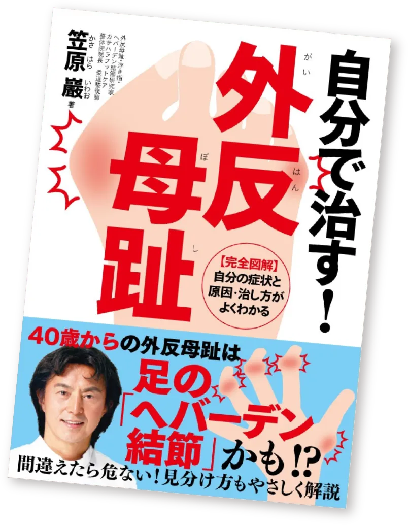自分で直す！外反母趾